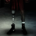'Gensan Punch': A Boxer with a Prosthetic Leg Strives for Greatness